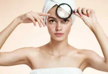 tratamientos-para-el-acne